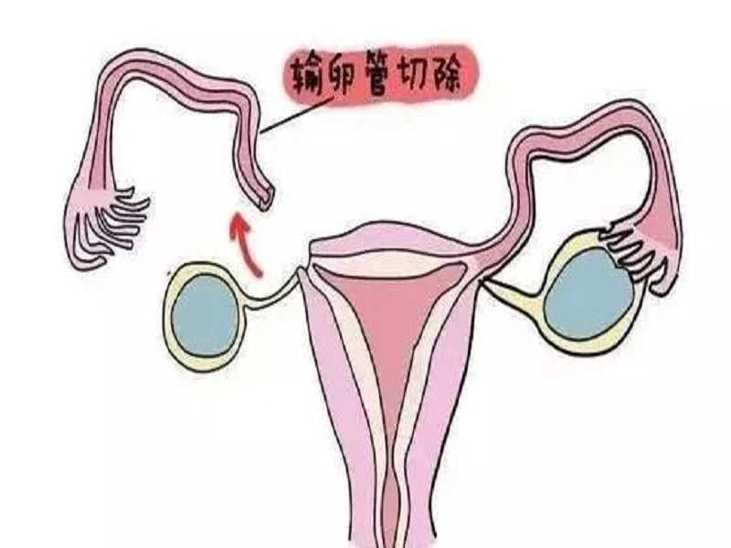 广州供卵助孕机构(供卵试管助孕机构)